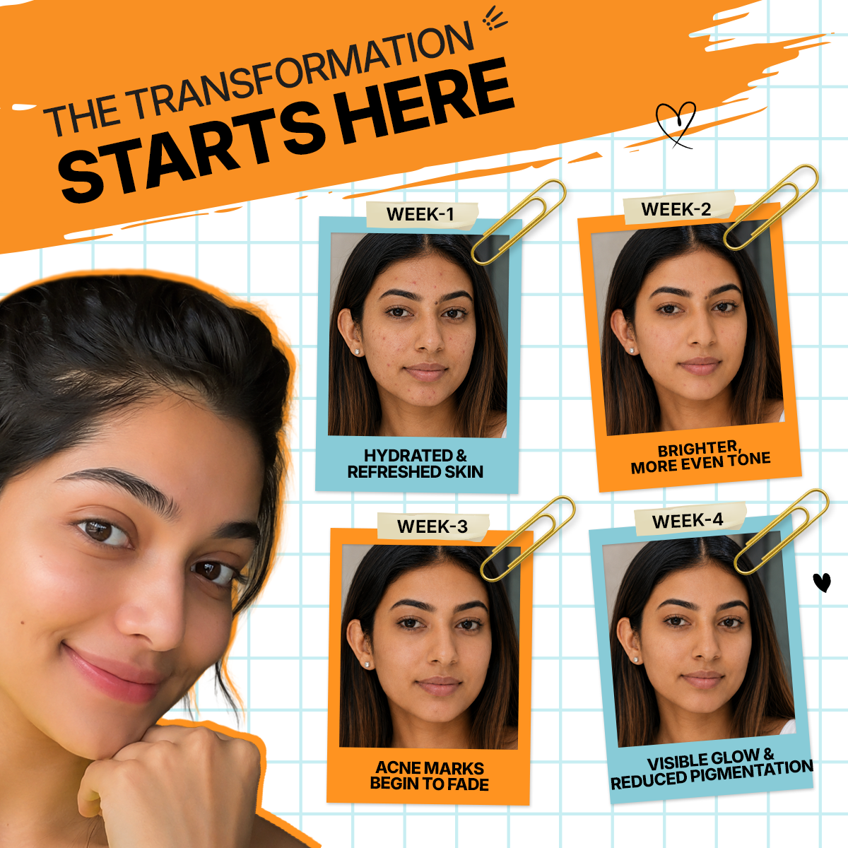 Magic Glow Roll-On By Dr.Veda for Acne, Acne Scars, Pigmentation & Dark Spot Reduction